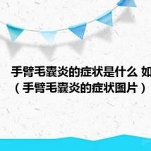 手臂毛囊炎的症状是什么 如何护理（手臂毛囊炎的症状图片）