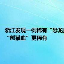 浙江发现一例稀有“恐龙血” 比“熊猫血”更稀有