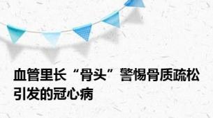 血管里长“骨头”警惕骨质疏松引发的冠心病