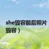 she毁容前后照片（she毁容）