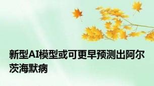 新型AI模型或可更早预测出阿尔茨海默病