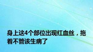 身上这4个部位出现红血丝，拖着不管该生病了