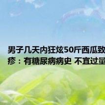 男子几天内狂炫50斤西瓜致带状疱疹：有糖尿病病史 不宜过量吃水果