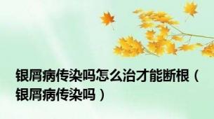 银屑病传染吗怎么治才能断根（银屑病传染吗）