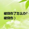 被烧伤了怎么办?（she被烧伤）