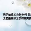 男子结婚22年胖30斤 戴婚戒的无名指肿胀无奈将其夹断