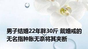 男子结婚22年胖30斤 戴婚戒的无名指肿胀无奈将其夹断