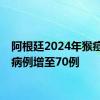 阿根廷2024年猴痘确诊病例增至70例