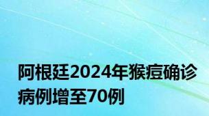 阿根廷2024年猴痘确诊病例增至70例