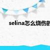 selina怎么烧伤的