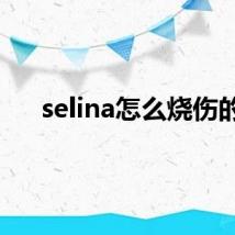 selina怎么烧伤的